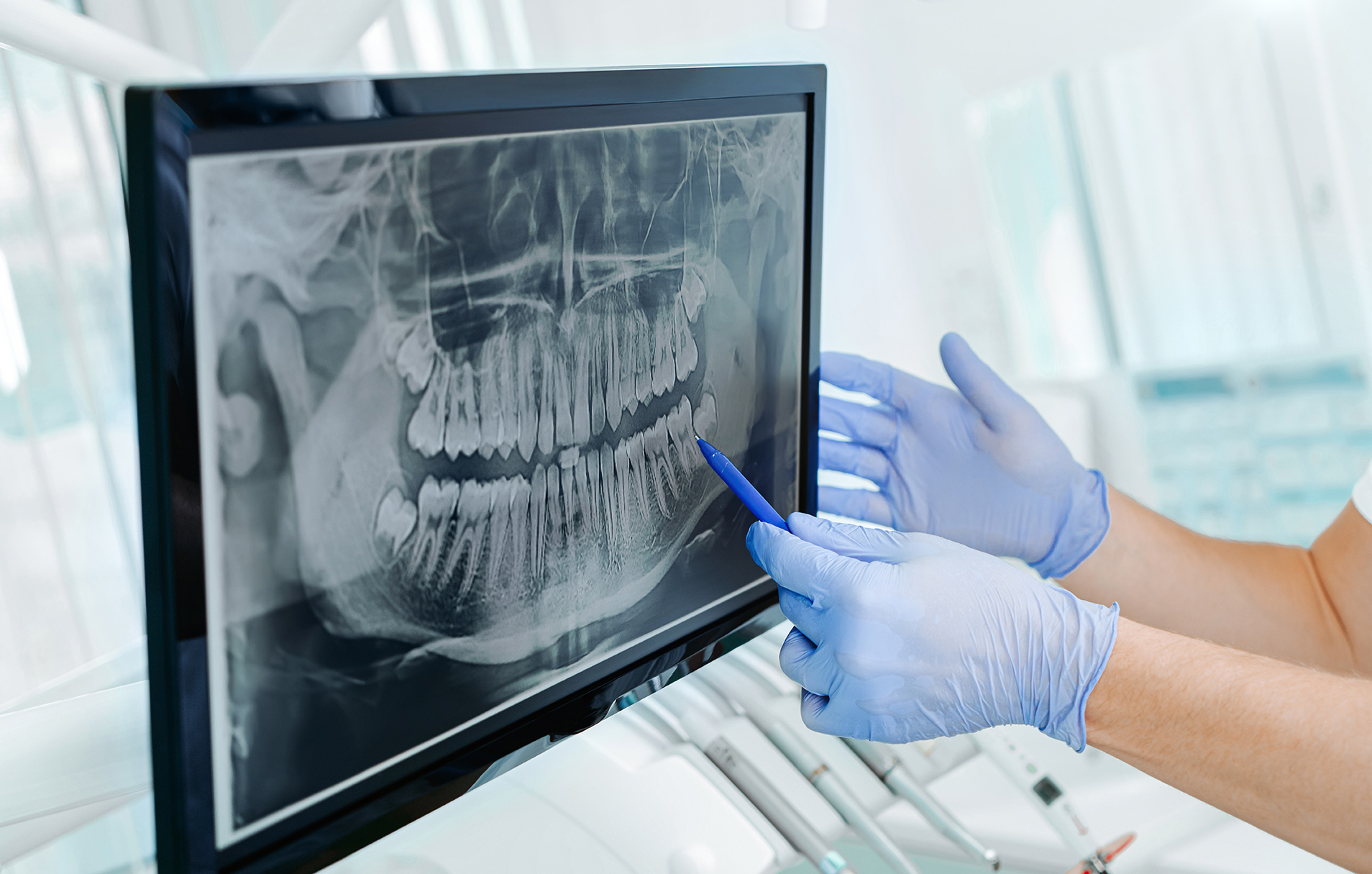 Dr. Maryana Horokhivska pointing to dental exam during implant dentistry consultation at new albany smiles