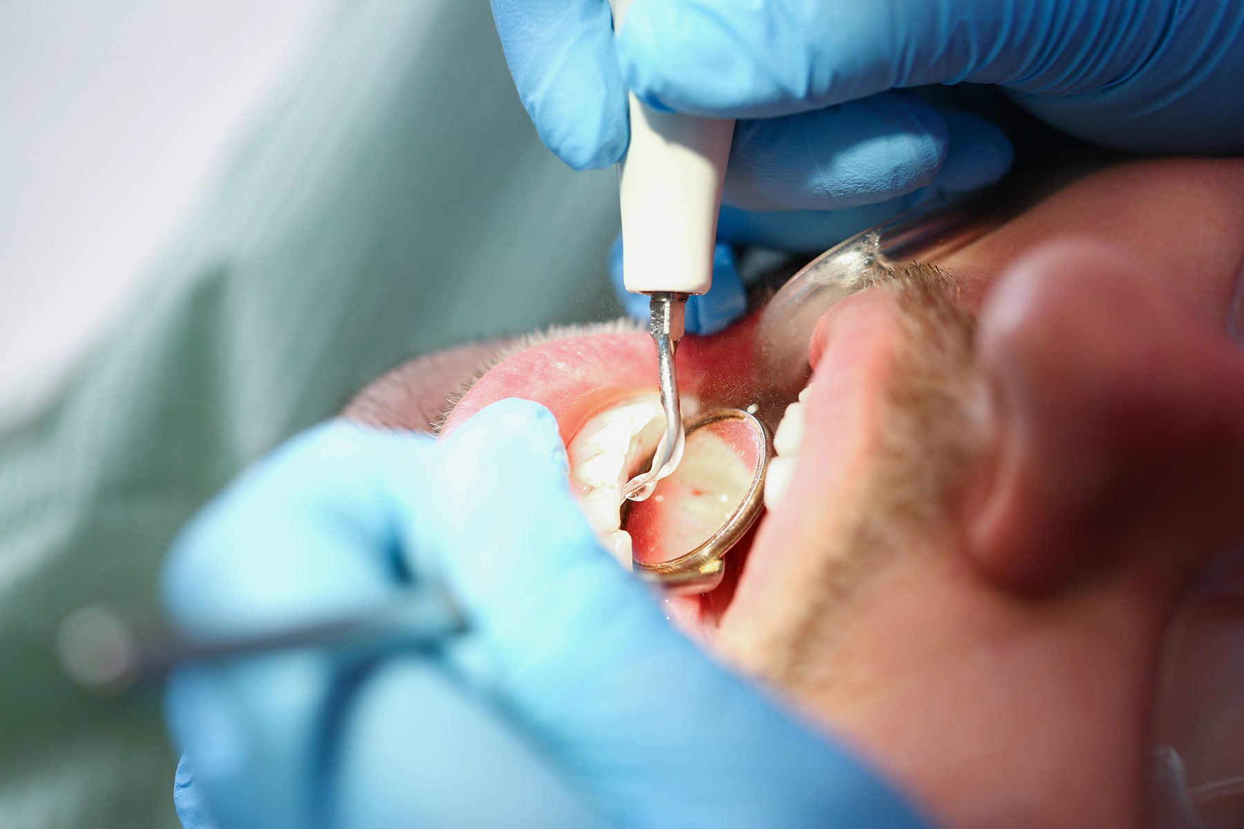 Man getting his teeth cleaned in New Albany, OH