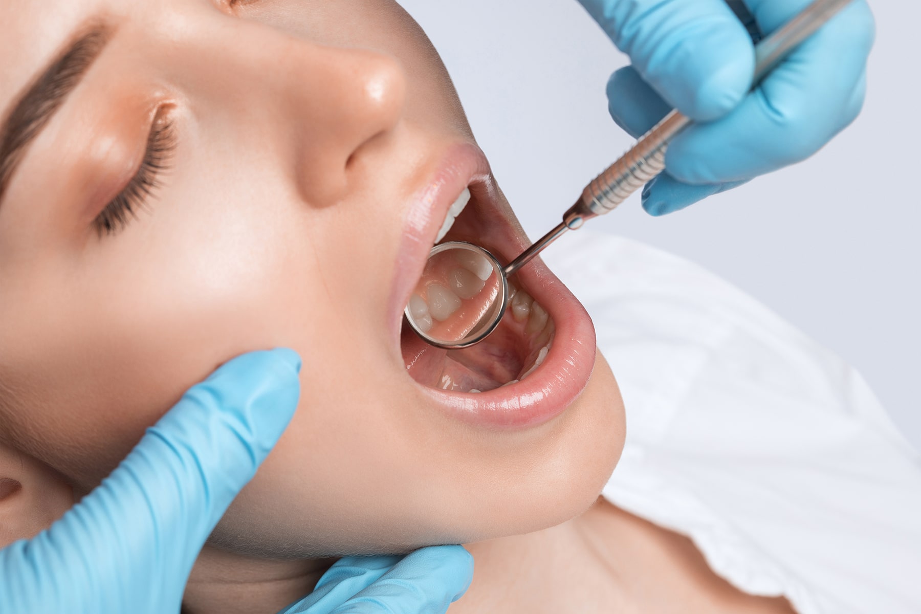NewAlbanyFillings-min Tooth fillings in New Albany, OH